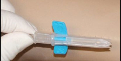 Picture of Arteriovenous Fistula Needle SafeTouch™ Tulip™ 15 Gauge 1 Inch 12 Inch Tubing Without PortFT+162530BC