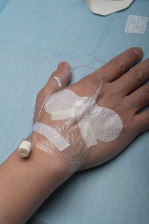 Picture of DEVICE, SECUREMENT SHEATH CVC PICC & ARTERIAL (50/BX)852