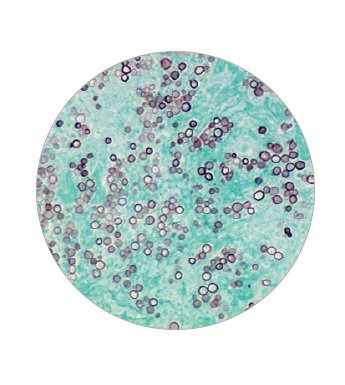 Picture of Modified Gomori Methenamine-Silver Nitrate (GMS) Stain Kit 15 mL, 7 X 125 mLSSK-GMS/GOMORI