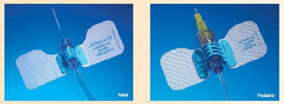 Picture of Stabilization Device StatLock®IV0564