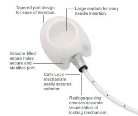 Picture of MRI Implantable Port X-Port Isp™ 8 Fr. Single Lumen0607540