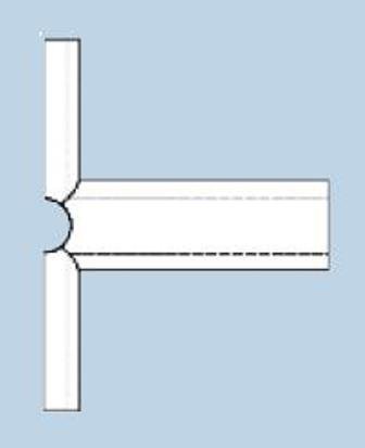 Picture of Ear Ventilation Tube Modified T 1.32 mm Silicone Blue Sterile240072