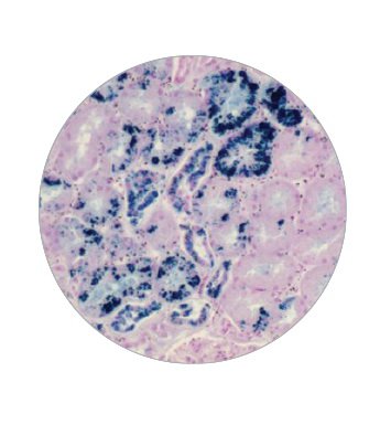 Picture of STAIN KIT, IRON D/SSSK-IRON