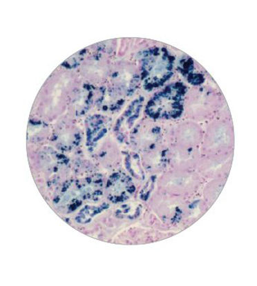 Picture of STAIN KIT, IRON D/SSSK-IRON