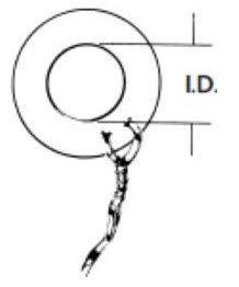 Picture of Ear Ventilation Tube Collar Button 1.5 mm Ultrasil Blue70241014