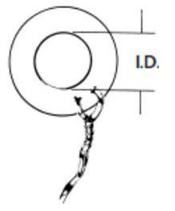 Picture of Ear Ventilation Tube Collar Button 1.5 mm Ultrasil Blue70241014