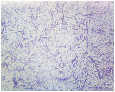 Picture of SLIDE, BACTERIA SMEAR TYPICALS06346PS