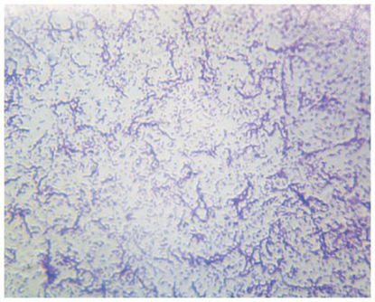 Picture of SLIDE, BACTERIA SMEAR TYPICALS06346PS