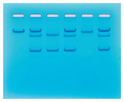 Picture of Sickle Cell Gene Detection (Dna-Based) Classroom Educational Kit Edvotek™ 8 gels, 45 minutes Time Range, RefrigeratedS94670