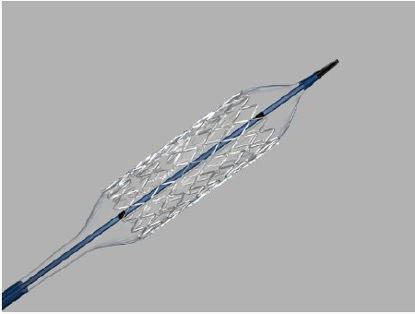 Picture of Renal Balloon Expandable Stent Formula 418® 6 Fr. Sheath / 7 Fr. Guiding Catheter 16 cm Stainless SteelG56616
