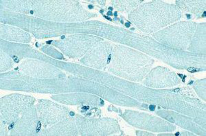Picture of SLIDE MUSCLE TISSUE SKELETAL96V3542
