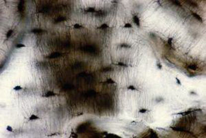 Picture of Teaching Microscope Slide Ground Bone 1 X 3 Inch936140