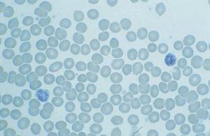 Picture of SLIDE HUMAN BLOOD93V6540