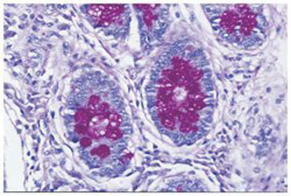 Picture of Periodic Acid Schiff (PAS) Stain Kit Richard-Allan Scientific™ 3 X 500 mL87007