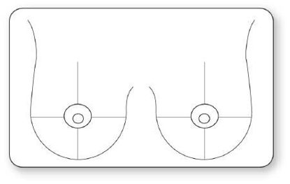 Picture of Pre-Printed Label UAL™ Advisory Label White Paper Breast Black Diagram / Symbol 1-1/2 X 2-1/2 InchULMC301