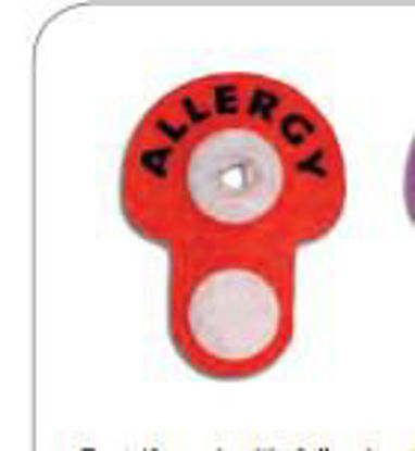 Picture of Identification Wristband Ident-Alert® Alert Band Permanent Snap Allergy8621A-16-PDH