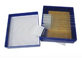 Picture of Control Slide Pneumocystis Tissue22026702