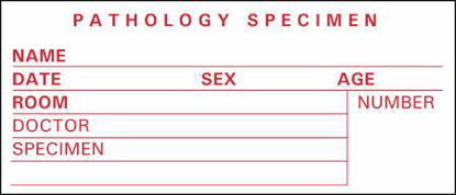 Picture of Pre-Printed Label Timemed Laboratory Use White Pathology Specimen, Name, Date, Sex, Age, Room, Doctor, Speciment, Number Red Lab / Specimen 1-1/2 X 3-1/2 InchSP-4