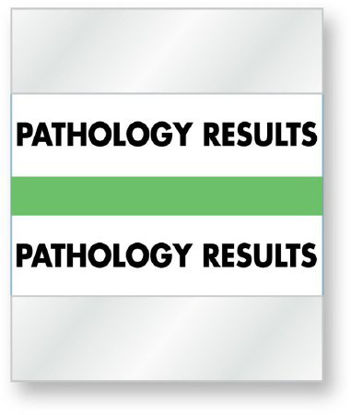 Picture of Pre-Printed Label WorkSafe™ Laboratory Use Green Fluorescent Paper PATHOLOGY RESULTS/PATHOLOGY RESULTS Black Lab / Specimen 1-1/4 X 1-1/2 InchULCD04