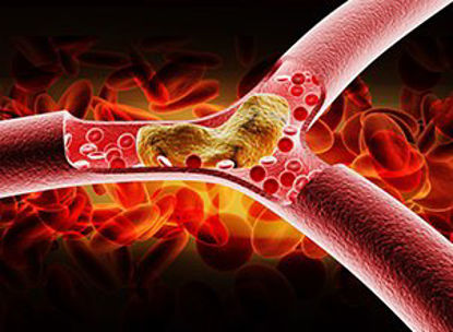 Picture of Reagent Caridac / Lipids / General Chemistry Triglycerides For Mindray™ BS-200 Analyzer 4 X 40 mL12-T7532-160
