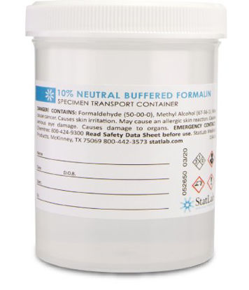 Picture of Prefilled Formalin Container Polypropylene 120 mL Fill in 240 mL (8 oz.) Screw Cap Warning Label / Patient Information NonSterileNB08120