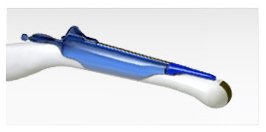 Picture of Endocavity Needle Guide Sterile, Disposable5055