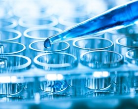 Picture of Reagent Kit Lactate Dehydrogenase R1: 500 mL, R2: 125 mLL7572625