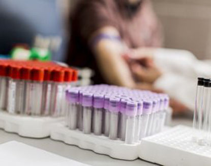 Picture of Reagent Glucose Oxidase For use with Automated Chemistry Analyzers 1 LiterG75211L