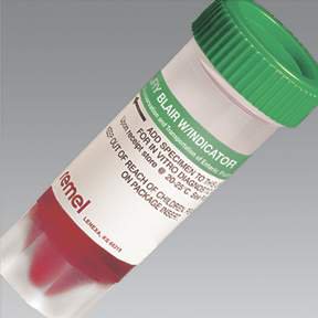 Picture of Stool Specimen Container Thermo Scientific™ Remel™ Single-Vial Set Plastic 15 mL Fill (0.5 oz.) Screw Cap with Sampling Device NonSterileR21925