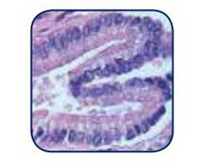 Picture of Lithium Blue Stain 1 gal.L-B1G