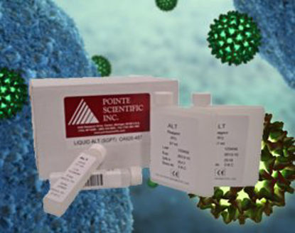 Picture of Reagent Renal / General Chemistry Urea Nitrogen (BUN) For AU400 Chemistry Analyzer 2,640 Tests R1: 6 X 66 mL, R2: 2 X 43 mLOB952482