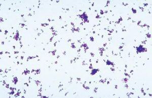 Picture of TUBE CULTURE C. XEROSIS 16X125MM D/S85C1008