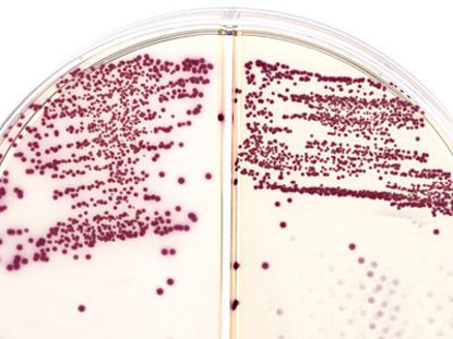 Picture of Prepared Media HardyCHROM™ Methicillin Resistant Staphylococcus Aureus Mono-Plate FormatJ35