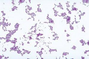 Picture of TUBE CULTURE LACTOCOCCUS 16X125MM D/S85C1150