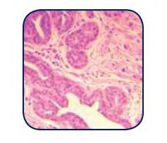 Picture of Eosin Y Stain 50 GramE-YP50GR