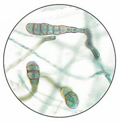 Picture of Prepared Microscope Slide Nocardia Species 1 X 3 Inch Prepared Slide670-03