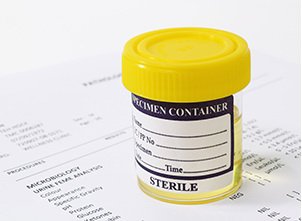 Picture of Reagent Alanine Aminotransferase (ALT) For Mindray™ BS-480 Analyzer R1: 5 X 62 mL, R2: 5 X 20 mL14-A7526-375