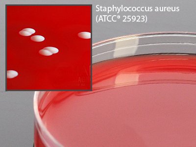 Picture of Prepared Media Columbia Naladixic Acid (CAN) Agar Red Petri Plate FormatA50BX