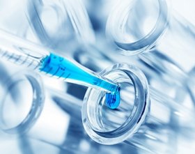 Picture of Reagent Hepatic / General Chemistry Gamma Glutamyl Transferase (GGT) 1 X 500 mLG7571625