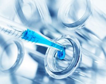 Picture of Reagent Hepatic / General Chemistry Gamma Glutamyl Transferase (GGT) 1 X 500 mLG7571625