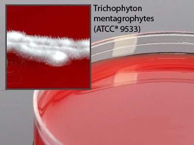 Picture of Prepared Media Brain Heart Infusion (BHI) Agar with Blood, Chloramphenicol and Gentamicin Deep Fill Plate FormatW65