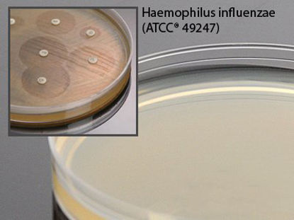 Picture of Haemophilus Test Medium Agar 15 X 100 mm For Susceptibility TestingG33