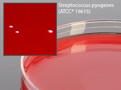 Picture of Prepared Media Tryptic Soy Agar (TSA) with 10% Sheep Blood Mono-Plate FormatA71