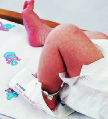 Picture of Instant Infant Heel Warmer Cardinal Health™ Heel One Size Fits Most Plastic Cover Disposable11460-010T