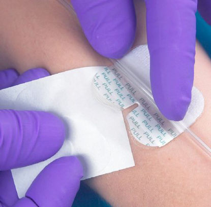 Picture of Nasal Gastric Securement Device GRIP-LOK® 2 Inch Length, Hydrocolloid2100NGH