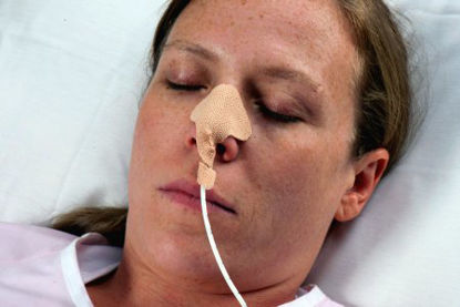 Picture of Nasogastric Tube Holder Dale® One Size Fits Most Adult Patients160