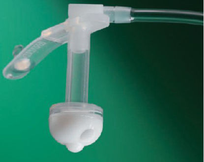 Picture of Button Gastrostomy Feeding Tube Bard® 28 Fr. 24 Inch Tube NonSterile000268