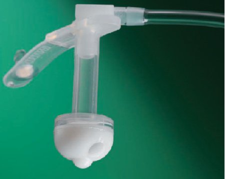 Picture of Button Gastrostomy Feeding Tube Bard® 28 Fr. 10 Inch Tube NonSterile000269