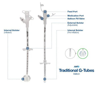 Picture of Gastrostomy Tube AMT 14 Fr. Adjustable up to 10cm Tube Silicone7-1410