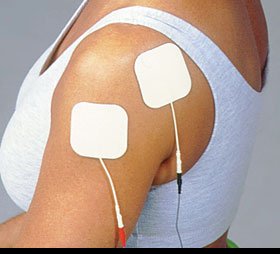 Picture of Pals® Neurostimulation Electrode3931